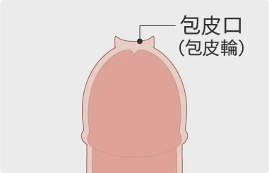 包皮論について